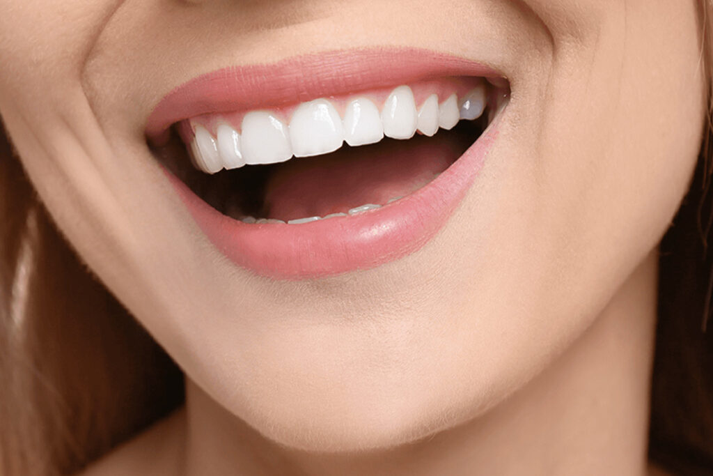Hollywood Smile w Turcji