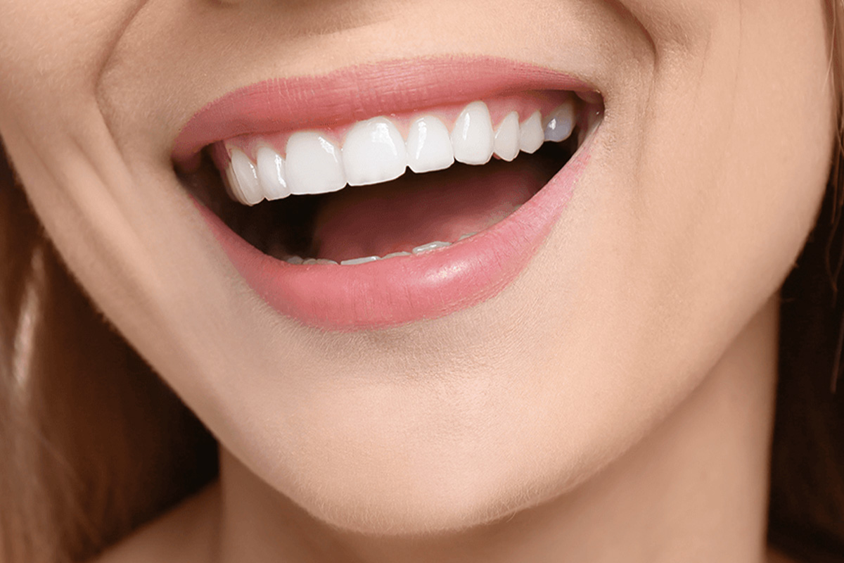 Hollywood Smile w Turcji